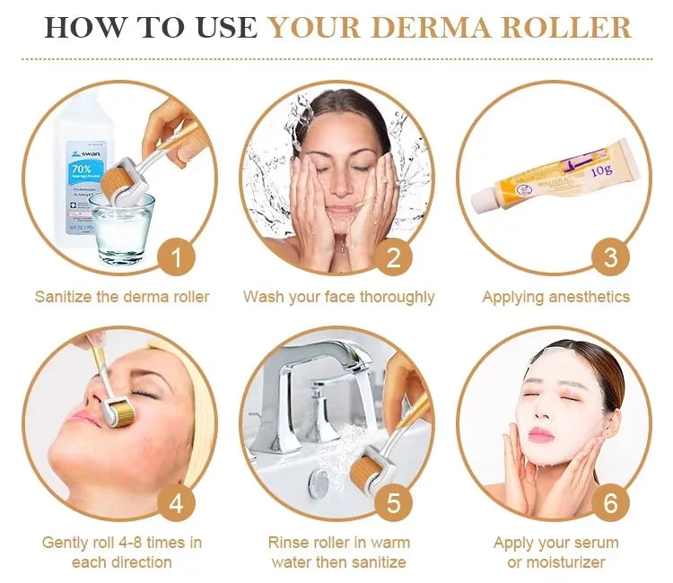 Needle Roller